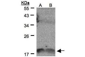 WB Image Sample(30 μg of whole cell lysate) A:H1299 B:HeLa S3, 12% SDS PAGE antibody diluted at 1:500 (IL1F9 抗体  (C-Term))
