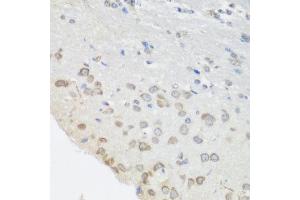 Immunohistochemistry of paraffin-embedded mouse brain using PUM1 antibody at dilution of 1:100 (40x lens). (PUM1 抗体)