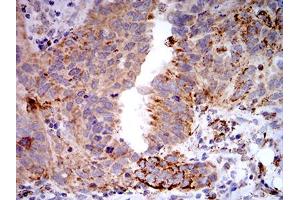 Immunohistochemistry (IHC) image for anti-Toll-Like Receptor 9 (TLR9) (AA 868-1016) antibody (ABIN5896728) (TLR9 抗体  (AA 868-1016))
