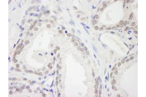 Immunohistochemistry (IHC) image for anti-RNA Binding Motif Protein 12 (RBM12) (AA 625-675) antibody (ABIN7448760)