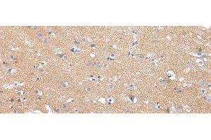 Immunohistochemistry of paraffin-embedded Human brain tissue using COLEC12 Polyclonal Antibody at dilution 1:40 (COLEC12 抗体)