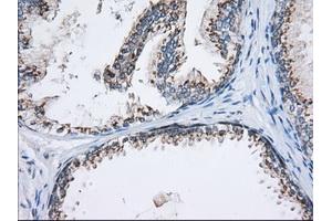 Immunohistochemical staining of paraffin-embedded Human Kidney tissue using anti-MOBKL1A mouse monoclonal antibody. (MOBKL1A 抗体)