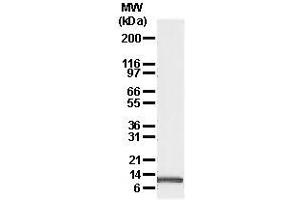 Image no. 1 for anti-Phorbol-12-Myristate-13-Acetate-Induced Protein 1 (PMAIP1) antibody (ABIN187551) (NOXA 抗体)