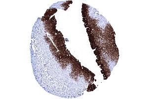 Urinary bladder urothelium Strong Upk1A immunostaining of the urothelium (UPK1A 抗体  (AA 114-173))