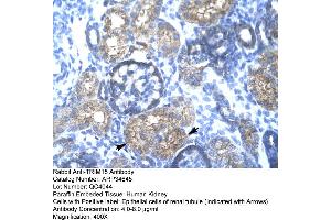 Human kidney (TRIM15 抗体  (N-Term))