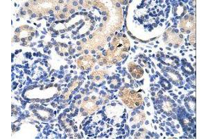 Image no. 1 for anti-EMG1 Nucleolar Protein Homolog (EMG1) (AA 51-100) antibody (ABIN6736233) (EMG1 抗体  (AA 51-100))