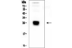 Western blot analysis of IGLL1 using anti-IGLL1 antibody (ABIN6719329).