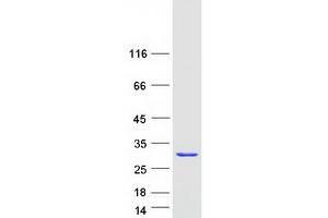 Western Blotting (WB) image for RAB2B, Member RAS Oncogene Family (RAB2B) protein (Myc-DYKDDDDK Tag) (ABIN2730315)