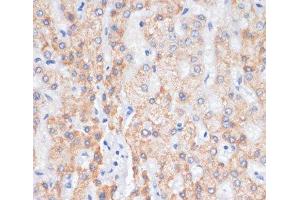 Immunohistochemistry of paraffin-embedded Human liver using AREG Polyclonal Antibody at dilution of 1:100 (40x lens). (Amphiregulin 抗体)