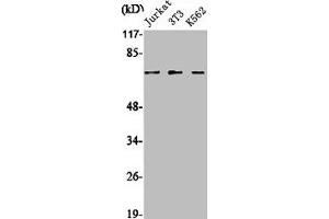 Western Blot analysis of Jurkat NIH-3T3 K562 cells using SENP1 Polyclonal Antibody (SENP1 抗体  (N-Term))
