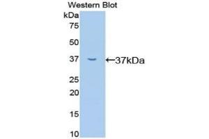 Detection of Recombinant RELA, Mouse using Polyclonal Antibody to Transcription Factor P65 (NFKB3) (NF-kB p65 抗体  (AA 19-306))