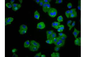 Immunofluorescence staining of HepG2 cells with ABIN7173341 at 1:66, counter-stained with DAPI. (TREH 抗体  (AA 373-507))