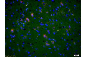 Formalin-fixed and paraffin-embedded rat brain labeled with Anti-Phospho-NMDAR2B (Tyr1336) Polyclonal Antibody, Unconjugated (ABIN801228) 1:200, overnight at 4°C, The secondary antibody was Goat Anti-Rabbit IgG, Cy3 conjugated used at 1:200 dilution for 40 minutes at 37°C. (GRIN2B 抗体  (pTyr1336))