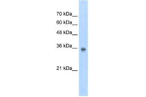 WB Suggested Anti-SOX2 Antibody Titration:  2. (SOX2 抗体  (N-Term))