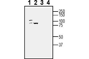 Western blot analysis of human  colorectal adenocarcinoma cell line lysate (lanes 1 and 3) and human SW403 colorectal adenocarcinoma cell line lysate (lanes 2 and 4):1-2.