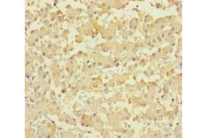 Immunohistochemistry of paraffin-embedded human liver tissue using ABIN7158418 at dilution of 1:100 (LPPR2 抗体  (AA 1-156))