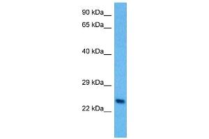 Host:  Mouse  Target Name:  PLP1  Sample Tissue:  Mouse Spleen  Antibody Dilution:  1ug/ml (PLP1 抗体  (N-Term))