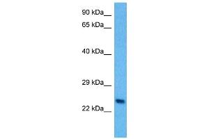 Host:  Mouse  Target Name:  PLP1  Sample Tissue:  Mouse Spleen  Antibody Dilution:  1ug/ml (PLP1 抗体  (N-Term))