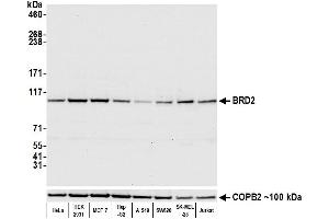 Western Blotting (WB) image for anti-Bromodomain Containing 2 (BRD2) (AA 675-725) antibody (ABIN7453322)