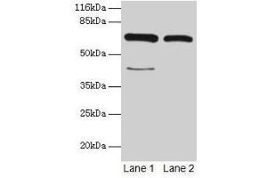 Western blot All lanes: CTPS1 antibody at 6 μg/mL Lane 1: Hela whole cell lysate Lane 2: 293T whole cell lysate Secondary Goat polyclonal to rabbit IgG at 1/10000 dilution Predicted band size: 67, 42 kDa Observed band size: 67 kDa (CTP Synthase 抗体  (AA 300-554))