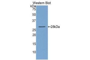 Western Blotting (WB) image for anti-Lysyl Oxidase-Like 1 (LOXL1) (AA 393-603) antibody (ABIN1859683) (LOXL1 抗体  (AA 393-603))