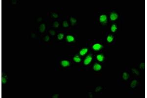 Immunofluorescence staining of Hela cells with ABIN7150950 at 1:100, counter-stained with DAPI. (CBX4 抗体  (AA 1-160))