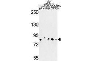 Western blot analysis of CHPF (arrow) in MDA-MB435, MCF-7, HepG2, A375 cell line and mouse testis tissue lysates (35ug/lane) using Chondroitin sulfate synthase 2 (CHPF 抗体  (Middle Region))