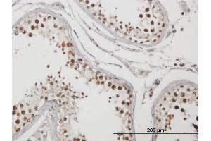 Immunoperoxidase of purified MaxPab antibody to C1orf25 on formalin-fixed paraffin-embedded human testis. (TRMT1L 抗体  (AA 1-733))