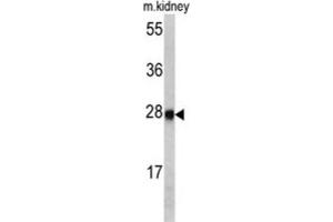 Western Blotting (WB) image for anti-Ethylmalonic Encephalopathy 1 (ETHE1) antibody (ABIN3002726) (ETHE1 抗体)