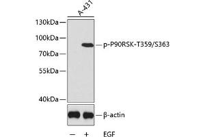 Western blot analysis of extracts of  cells, using Phospho-p90Rsk/RSK1/RPS6K-T359/S363 antibody (ABIN6135276, ABIN6136174, ABIN6136175 and ABIN6225566). (RPS6KA1 抗体  (pSer363, pThr359))