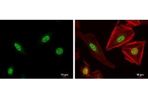 ICC/IF Image XBP1 antibody [N3C3] detects XBP1 protein at nucleus by immunofluorescent analysis. (XBP1 抗体)