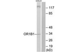Western blot analysis of extracts from COLO cells, using OR1B1 Antibody. (OR1B1 抗体  (AA 161-210))