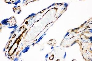 IHC-P: Caveolin-1 antibody testing of human placenta tissue (Caveolin-1 抗体  (AA 4-178))