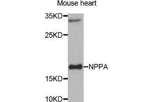 Western blot analysis of extracts of Mouse heart tissue, using NPPA antibody. (NPPA 抗体)