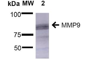 Western Blot analysis of Rat Brain showing detection of ~92 kDa and ~82 kDa (pro and active) MMP9 protein using Mouse Anti-MMP9 Monoclonal Antibody, Clone S51-82 . (MMP 9 抗体  (AA 1-708) (Atto 488))