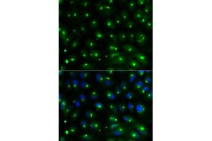 Immunofluorescence analysis of MCF-7 cell using GGA2 antibody. (GGA2 抗体  (AA 1-300))
