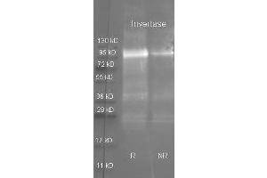 Goat anti Invertase antibody  was used to detect purified invertase under reducing (R) and non-reducing (NR) conditions. (Invertase 抗体)