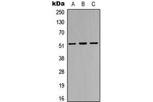 Western blot analysis of IRX3 expression in HEK293T (A), PC12 (B), HeLa (C) whole cell lysates. (IRX3 抗体  (Center))