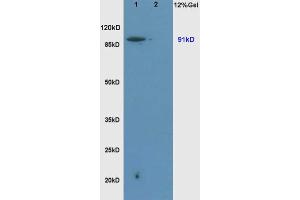 Western Blotting (WB) image for anti-Solute Carrier Family 9, Subfamily A (NHE1, Cation Proton Antiporter 1), Member 1 (SLC9A1) (AA 470-550) antibody (ABIN669426)