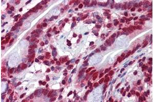 Human Small Intestine: Formalin-Fixed, Paraffin-Embedded (FFPE) (RHOU 抗体  (C-Term))