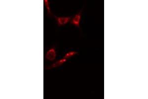 ABIN6278589 staining  HepG2 cells by IF/ICC. (MAK 抗体  (Internal Region))
