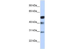 Western Blotting (WB) image for anti-Transcription Factor AP-2 beta (Activating Enhancer Binding Protein 2 Beta) (TFAP2B) (N-Term) antibody (ABIN2777939)