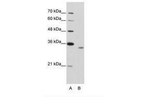 Image no. 2 for anti-RNA Binding Motif Protein 4B (RBM4B) (AA 290-339) antibody (ABIN202338) (RBM4B 抗体  (AA 290-339))