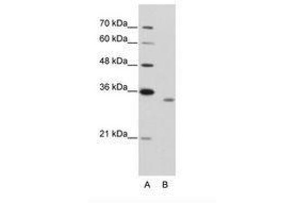RBM4B 抗体  (AA 290-339)