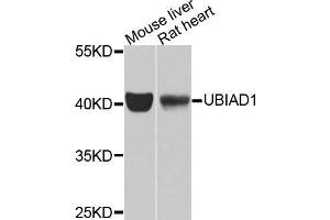 Western blot analysis of extracts of various cell lines, using UBIAD1 antibody (ABIN5975826) at 1/1000 dilution. (UBIAD1 抗体)