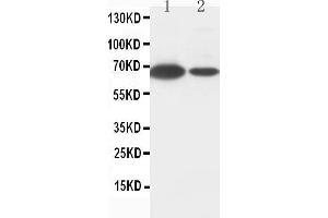 Anti-Lamin B1 antibody, Western blotting Lane 1: MCF-7 Cell Lysate Lane 2: HELA Cell Lysate (Lamin B1 抗体  (C-Term))