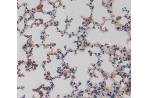 Used in DAB staining on fromalin fixed paraffin- embedded lung tissue (ERP29 抗体  (AA 42-173))