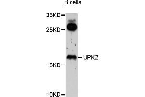 Western blot analysis of extracts of B-cell cells, using UPK2 antibody (ABIN4905559) at 1:1000 dilution. (Uroplakin 2 抗体)