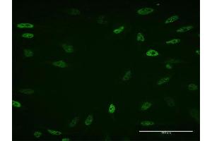 Immunofluorescence of monoclonal antibody to ZBTB33 on HeLa cell. (ZBTB33 抗体  (AA 564-673))