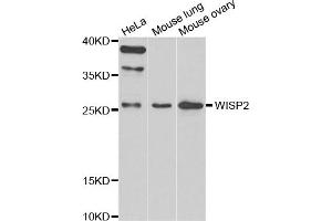 Western Blotting (WB) image for anti-WNT1 Inducible Signaling Pathway Protein 2 (WISP2) antibody (ABIN6571151)